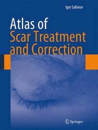 bokomslag Atlas of Scar Treatment and Correction