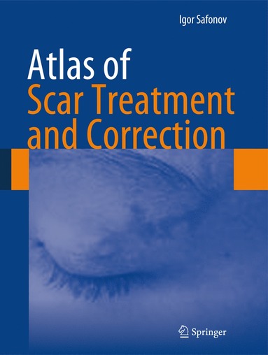 bokomslag Atlas of Scar Treatment and Correction