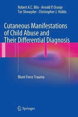 Robert A.C. Bilo, Arnold P. Oranje, Tor Shwayder, Christopher J. Hobbs, Robert A. C. Bilo - Cutaneous Manifestations of Child Abuse and Their Differential Diagnosis, Inbunden