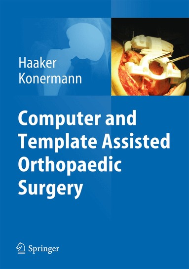 Rolf Haaker, Werner Konermann - Computer and Template Assisted Orthopedic Surgery, Inbunden