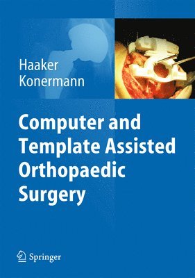 bokomslag Computer and Template Assisted Orthopedic Surgery