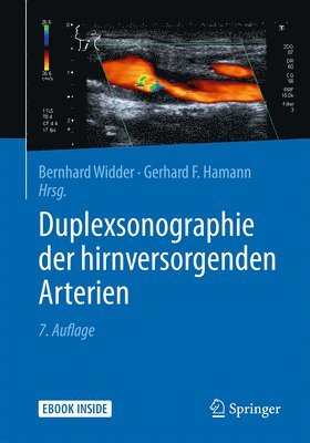 bokomslag Duplexsonographie der hirnversorgenden Arterien