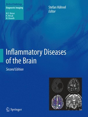 bokomslag Inflammatory Diseases of the Brain