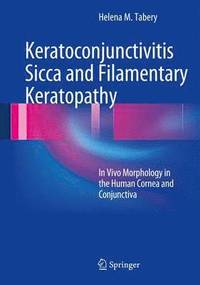 bokomslag Keratoconjunctivitis Sicca and Filamentary Keratopathy