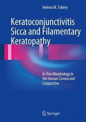 Keratoconjunctivitis Sicca and Filamentary Keratopathy 1