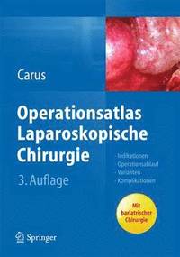 bokomslag Operationsatlas Laparoskopische Chirurgie