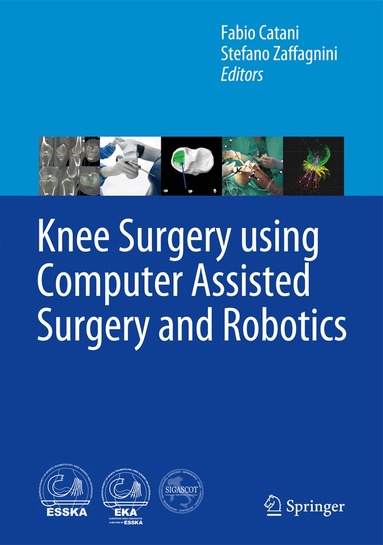 Fabio Catani, Stefano Zaffagnini - Knee Surgery using Computer Assisted Surgery and Robotics, Inbunden