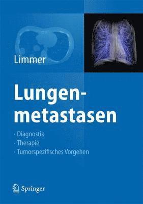 Lungenmetastasen 1