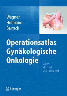 Uwe Wagner, Rainer Hofmann, Detlef K. Bartsch - Operationsatlas Gynäkologische Onkologie, Inbunden