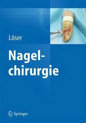 bokomslag Nagelchirurgie