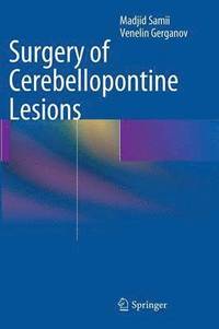 bokomslag Surgery of Cerebellopontine Lesions