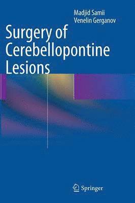 Surgery of Cerebellopontine Lesions 1