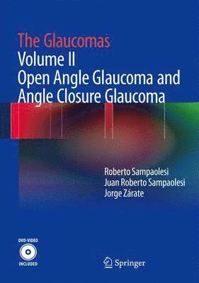 The Glaucomas: Volume II - Open Angle Glaucoma and Angle Closure Glaucoma