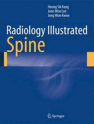Heung Sik Kang, Joon Woo Lee, Jong Won Kwon - Radiology Illustrated: Spine, Inbunden