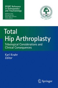 bokomslag Total Hip Arthroplasty