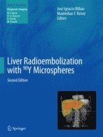 bokomslag Liver Radioembolization with 90Y Microspheres
