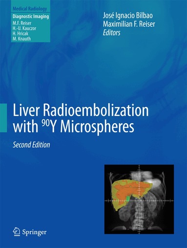 José Ignacio Bilbao, Maximilian F Reiser - Liver Radioembolization with 90Y Microspheres, Inbunden