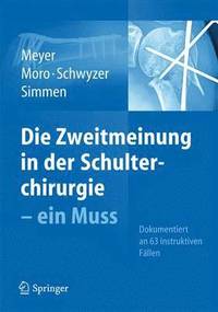 bokomslag Die Zweitmeinung in der Schulterchirurgie - ein Muss