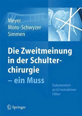 bokomslag Die Zweitmeinung in der Schulterchirurgie - ein Muss