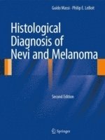 bokomslag Histological Diagnosis of Nevi and Melanoma