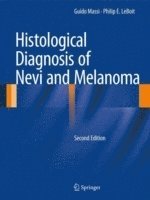 Histological Diagnosis of Nevi and Melanoma 1