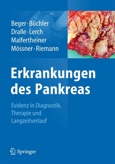 Hans G. Beger, Markus W. Büchler, Henning Dralle, Markus M. Lerch, Peter Malfertheiner, Joachim Mössner, Jürgen F. Riemann - Erkrankungen des Pankreas, Inbunden