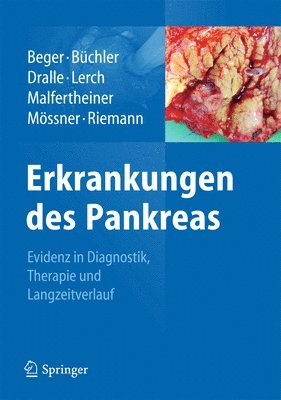 bokomslag Erkrankungen des Pankreas