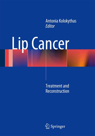Antonia Kolokythas - Lip Cancer, Inbunden