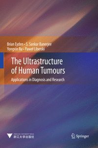 bokomslag The Ultrastructure of Human Tumours