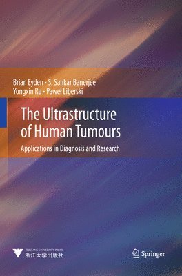 Ultrastructure of Human Tumours