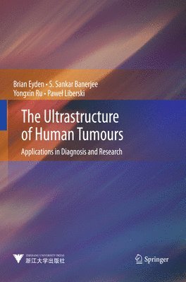 The Ultrastructure of Human Tumours 1