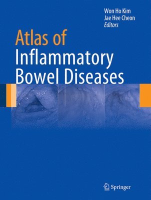 Atlas of Inflammatory Bowel Diseases 1