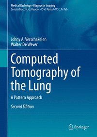 bokomslag Computed Tomography of the Lung