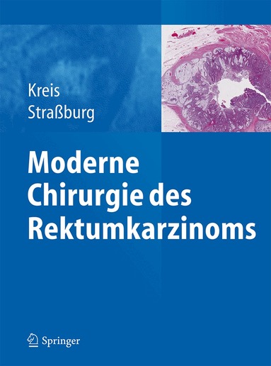 Martin E. Kreis, Joachim Straßburg - Moderne Chirurgie des Rektumkarzinoms, Inbunden