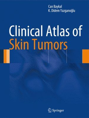 Clinical Atlas of Skin Tumors 1