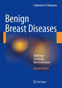 bokomslag Benign Breast Diseases