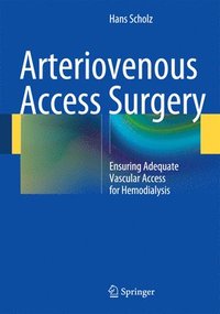 bokomslag Arteriovenous Access Surgery