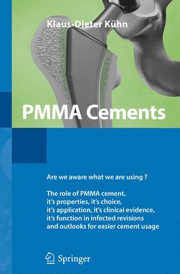 PMMA Cements 1