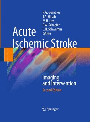 bokomslag Acute Ischemic Stroke