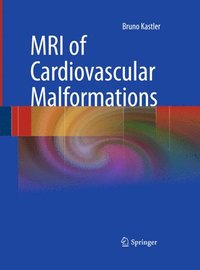 bokomslag MRI of Cardiovascular Malformations