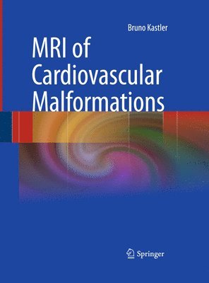 bokomslag MRI of Cardiovascular Malformations