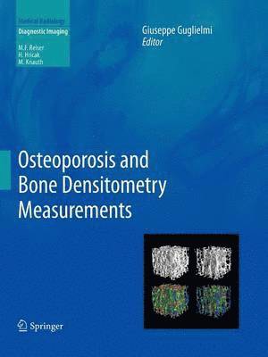 Osteoporosis and Bone Densitometry Measurements 1