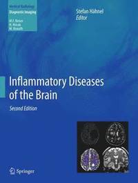 bokomslag Inflammatory Diseases of the Brain