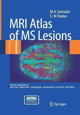 bokomslag MRI Atlas of MS Lesions