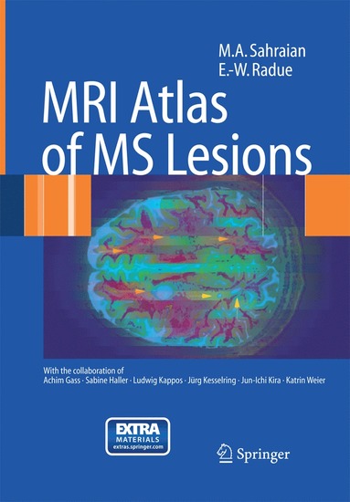 bokomslag MRI Atlas of MS Lesions