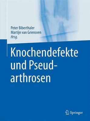 bokomslag Knochendefekte und Pseudarthrosen