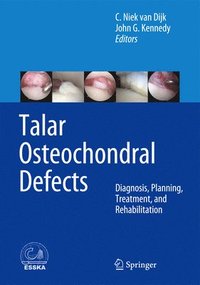 bokomslag Talar Osteochondral Defects