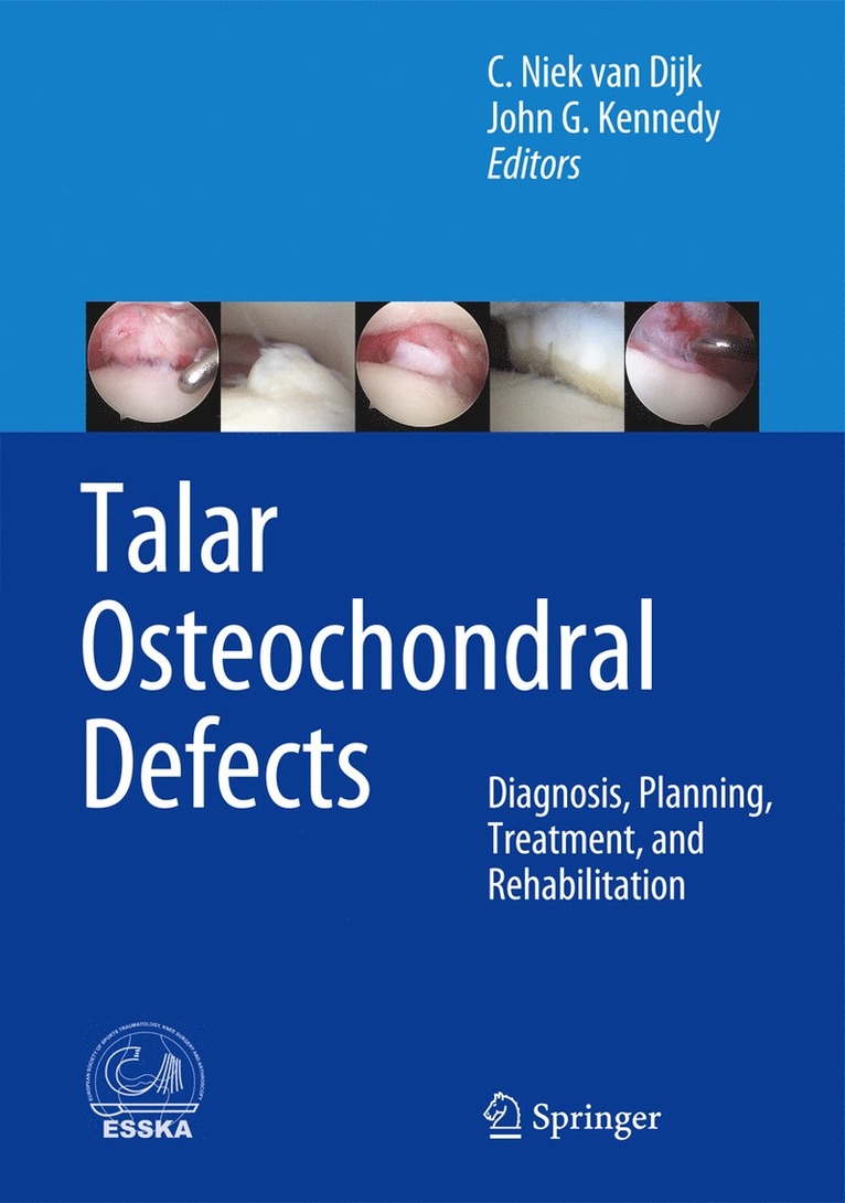 C. Niek van Dijk, John G. Kennedy, C. Niek Van Dijk - Talar Osteochondral Defects, Inbunden