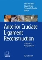 bokomslag Anterior Cruciate Ligament Reconstruction