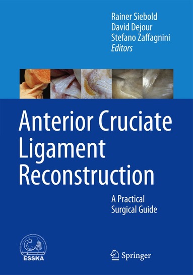 Rainer Siebold, David Dejour, Stefano Zaffagnini - Anterior Cruciate Ligament Reconstruction, Inbunden
